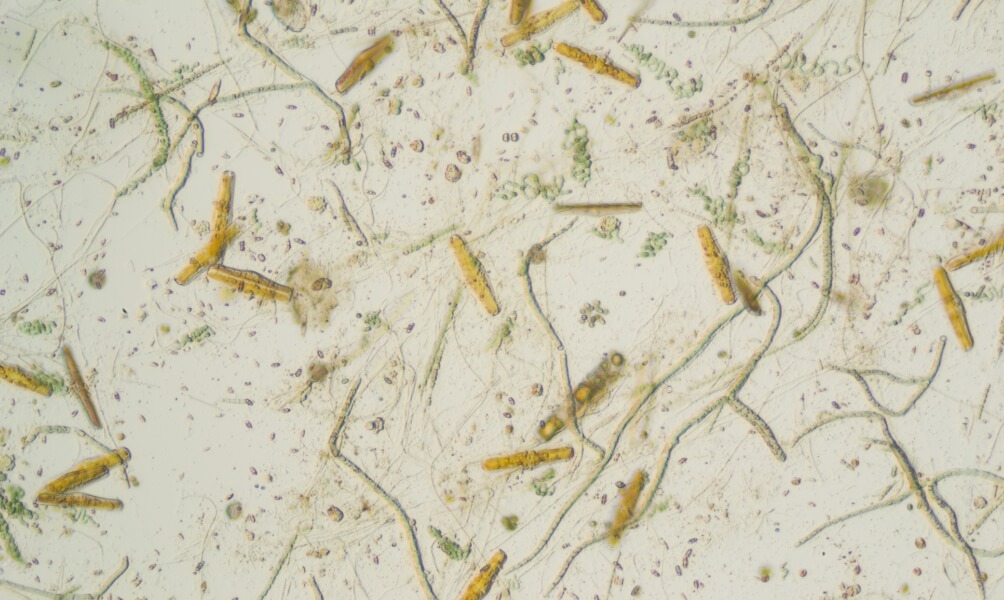 微生物はこんなに大事!
